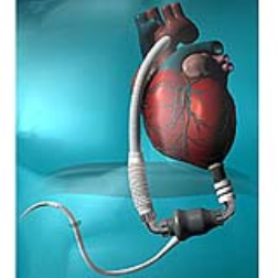 The "continuous flow pump" channels  blood through the entire body on a non-stop basis