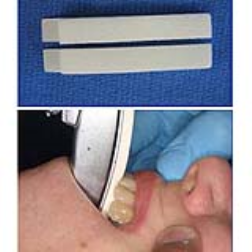 A disposable foam strip for preventing damaging patients teeth during intubation