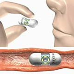 An ingestible pill-shaped device with a rotating camera can capture images from inside the digestive track