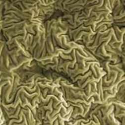 Wrinkled hard skin can now be developed on a polymer surface by using a  focused ion beam