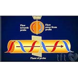 The artificial artery has a "rifled" surface inside to encourage blood movement