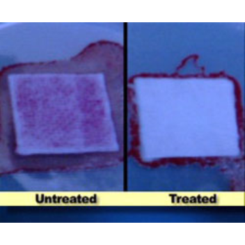 Researchers have developed a new type of wound dressing that could stop the spread of antibiotic resistant bacteria