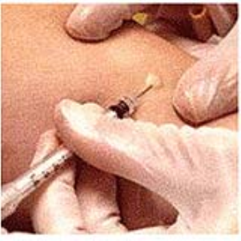 An intra-dermal application via the dendritic cells will give stronger cellular immunity