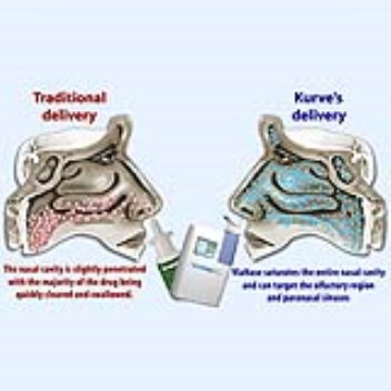 A drug delivery system that delivers aerosolized particles to the nose